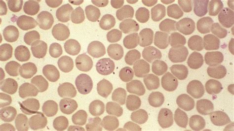  Babesia - Parasitic Protozoan Capable Of Hiding In Red Blood Cells And Affecting Both Wild And Domestic Animals!