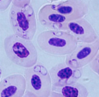 Babesia? A Tiny Parasite That Can Cause Big Trouble in Mammals!