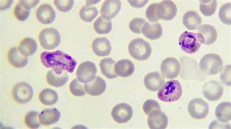  Falciparum Malaria Parasite:  The Tiny Terror That Hides Within Human Blood Cells!